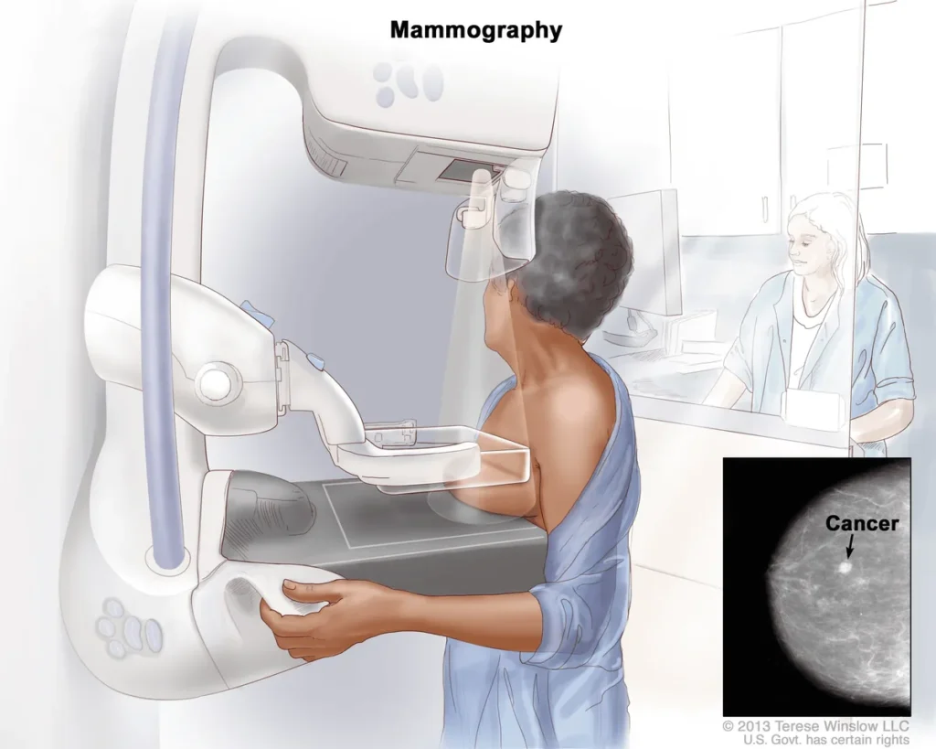 Cancer Screening Guide: Key Highlights of Screening