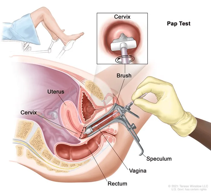 Cancer Screening Guide: Key Highlights of Screening