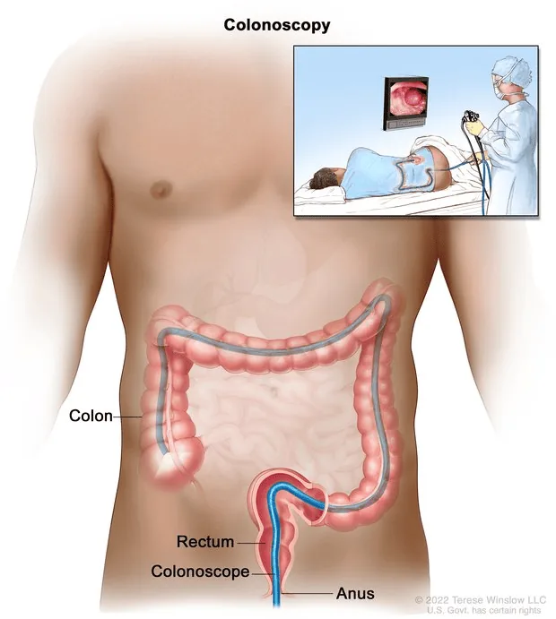Cancer Screening Guide: Key Highlights of Screening