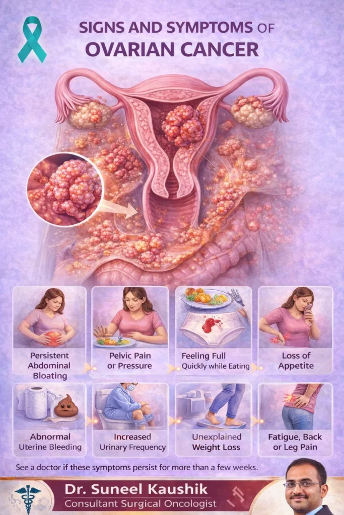 Ovarian Cancer: Common Symptoms (Often Subtle)